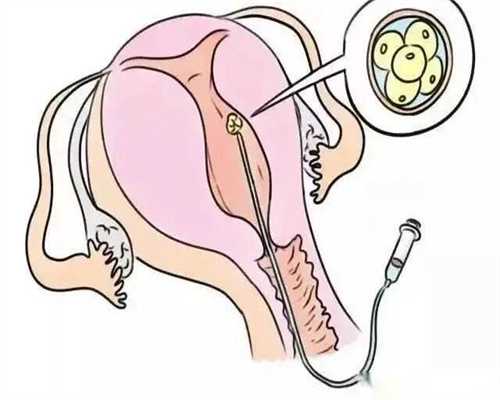 孕前需要注意什么事项和饮食